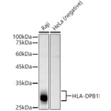 Western Blot - Anti-MHC Class II beta Antibody (A13448) - Antibodies.com