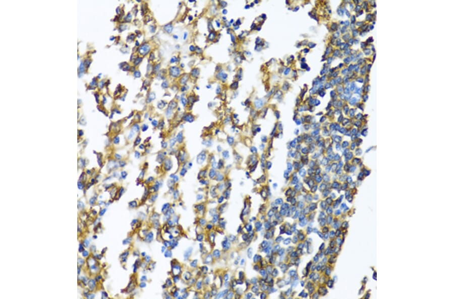 Immunohistochemistry - Anti-MHC Class II beta Antibody (A13448) - Antibodies.com