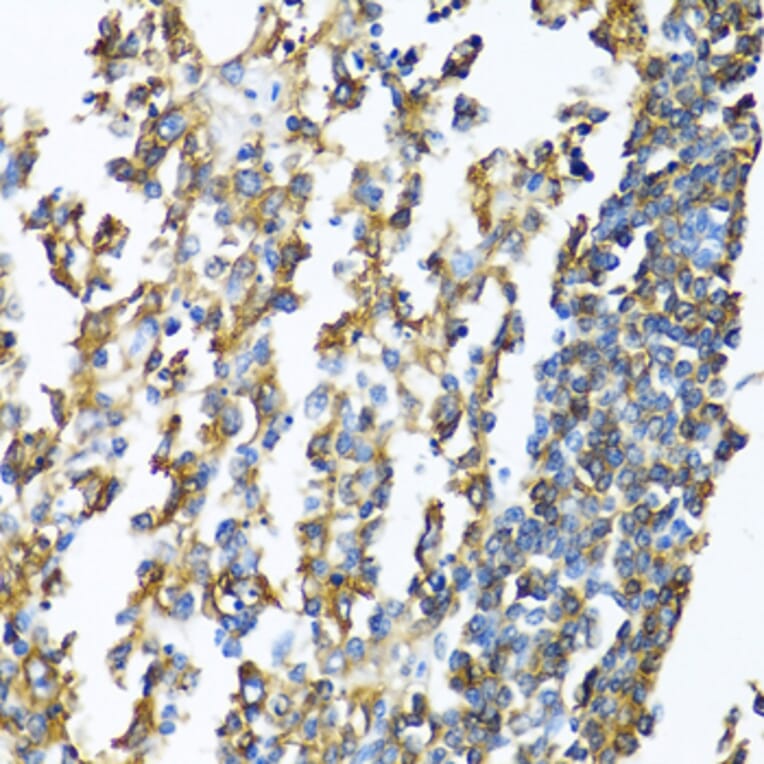 Immunohistochemistry - Anti-MHC Class II beta Antibody (A13448) - Antibodies.com