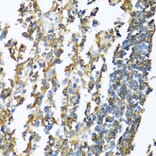 Immunohistochemistry - Anti-MHC Class II beta Antibody (A13448) - Antibodies.com