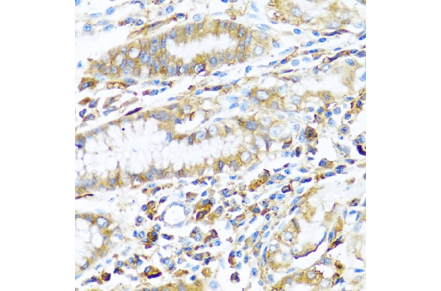 Immunohistochemistry - Anti-MHC Class II beta Antibody (A13448) - Antibodies.com