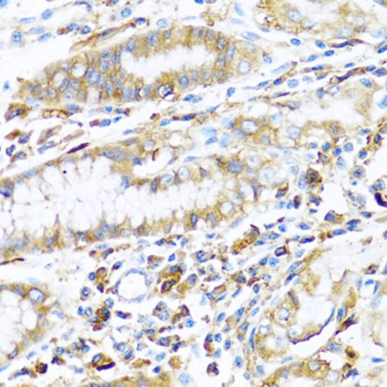 Immunohistochemistry - Anti-MHC Class II beta Antibody (A13448) - Antibodies.com