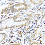 Immunohistochemistry - Anti-MHC Class II beta Antibody (A13448) - Antibodies.com
