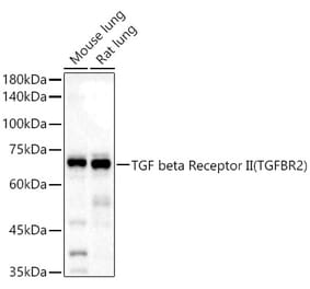 Western Blot - Anti-TGF beta Receptor II Antibody (A13449) - Antibodies.com