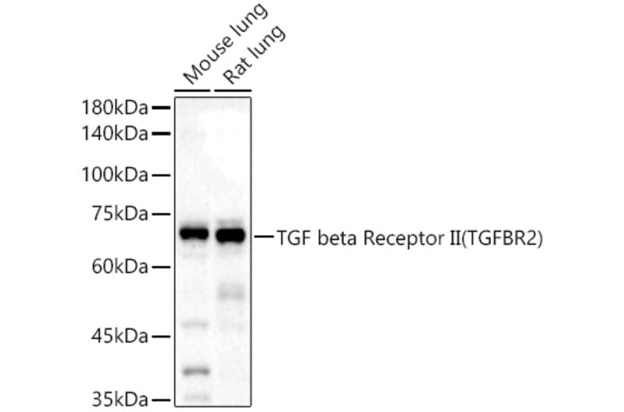 Western Blot - Anti-TGF beta Receptor II Antibody (A13449) - Antibodies.com