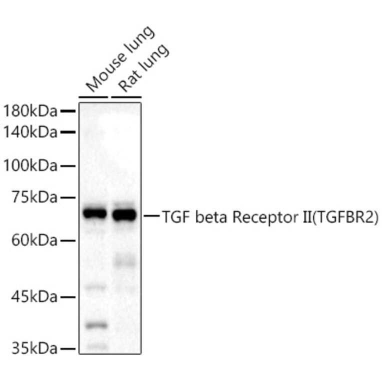 Western Blot - Anti-TGF beta Receptor II Antibody (A13449) - Antibodies.com