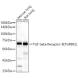 Western Blot - Anti-TGF beta Receptor II Antibody (A13449) - Antibodies.com