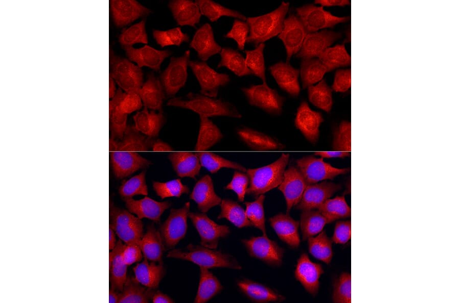Immunofluorescence - Anti-TGF beta Receptor II Antibody (A13449) - Antibodies.com