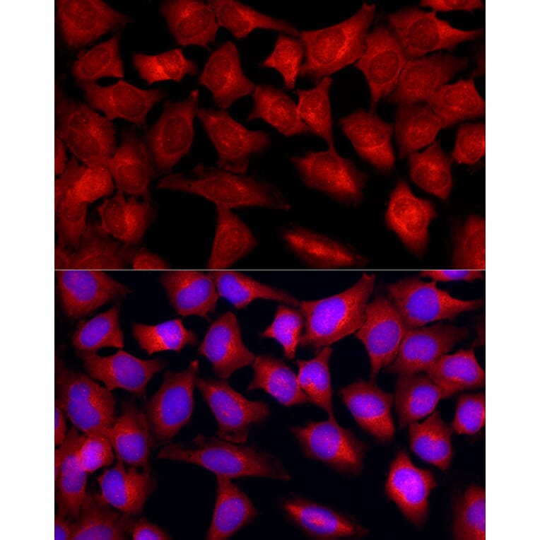 Immunofluorescence - Anti-TGF beta Receptor II Antibody (A13449) - Antibodies.com
