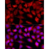 Immunofluorescence - Anti-TGF beta Receptor II Antibody (A13449) - Antibodies.com
