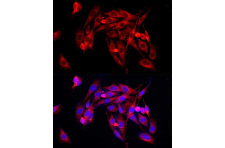 Immunofluorescence - Anti-TGF beta Receptor II Antibody (A13449) - Antibodies.com