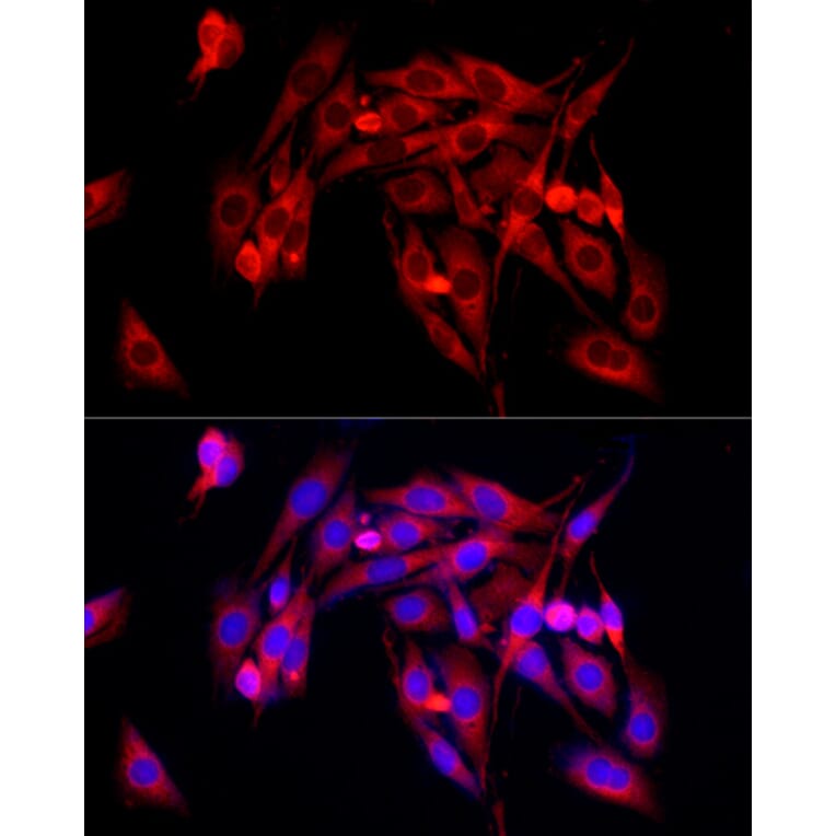 Immunofluorescence - Anti-TGF beta Receptor II Antibody (A13449) - Antibodies.com