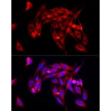 Immunofluorescence - Anti-TGF beta Receptor II Antibody (A13449) - Antibodies.com