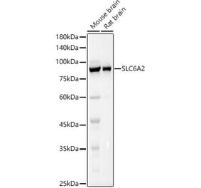 Western Blot - Anti-Noradrenaline transporter Antibody (A13450) - Antibodies.com