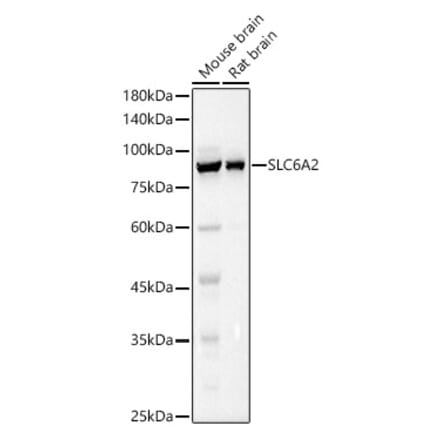 Western Blot - Anti-Noradrenaline transporter Antibody (A13450) - Antibodies.com