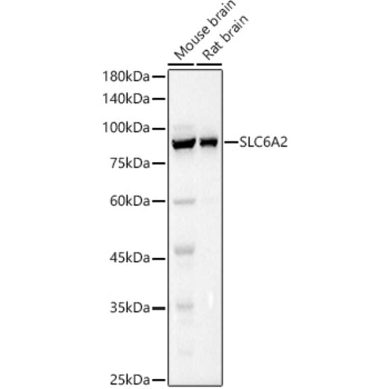 Western Blot - Anti-Noradrenaline transporter Antibody (A13450) - Antibodies.com
