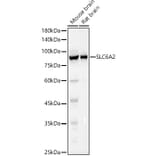 Western Blot - Anti-Noradrenaline transporter Antibody (A13450) - Antibodies.com