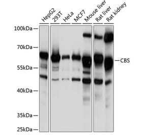 Western Blot - Anti-CBS Antibody (A13451) - Antibodies.com