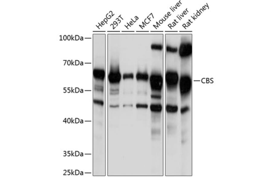 Western Blot - Anti-CBS Antibody (A13451) - Antibodies.com