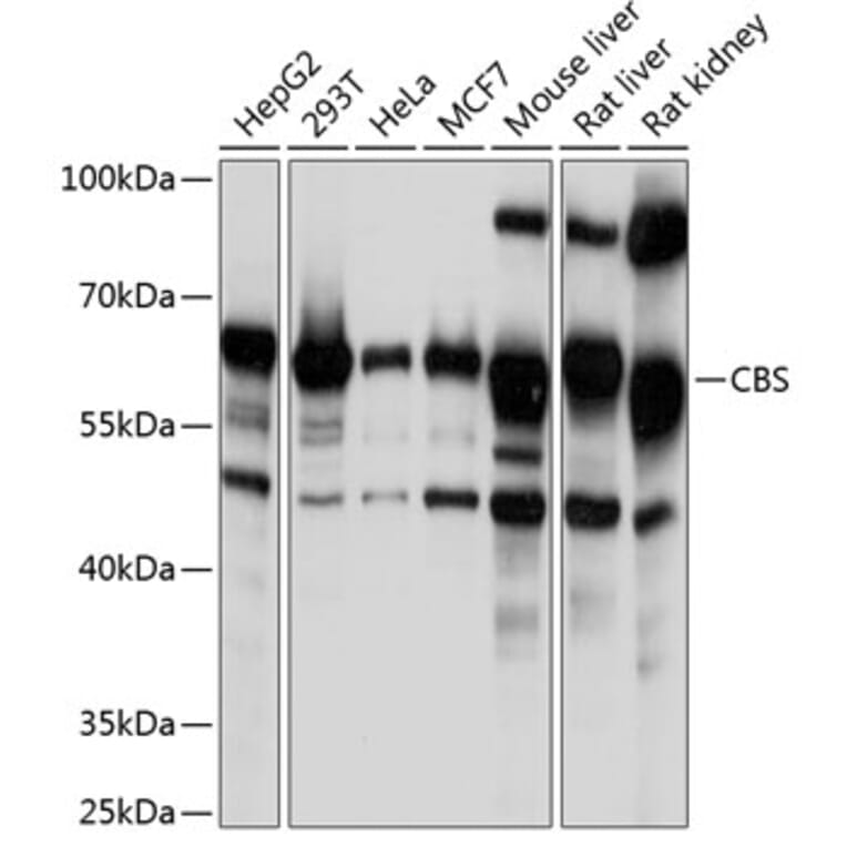 Western Blot - Anti-CBS Antibody (A13451) - Antibodies.com