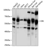 Western Blot - Anti-CBS Antibody (A13451) - Antibodies.com