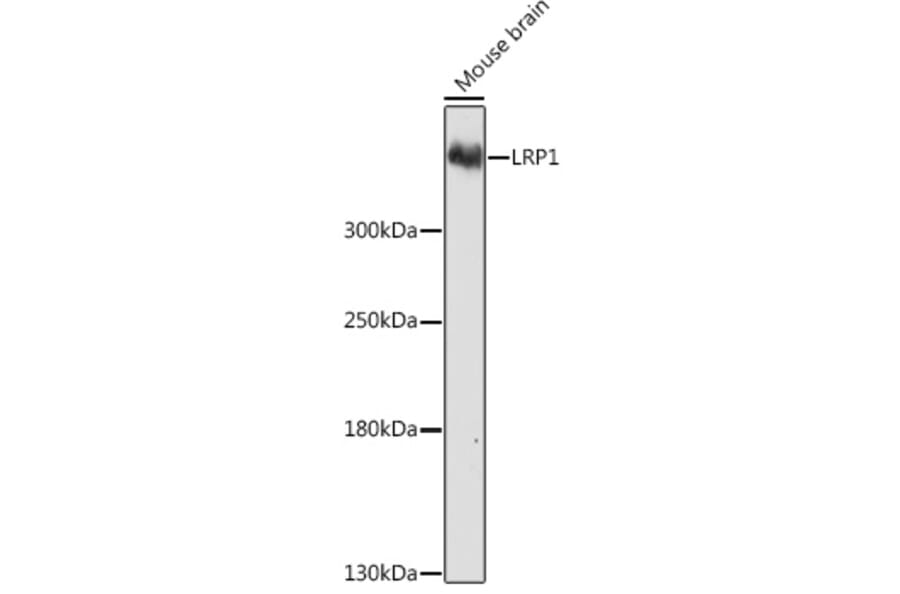 Western Blot - Anti-LRP1 Antibody (A13452) - Antibodies.com