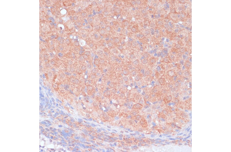 Immunohistochemistry - Anti-LRP1 Antibody (A13452) - Antibodies.com
