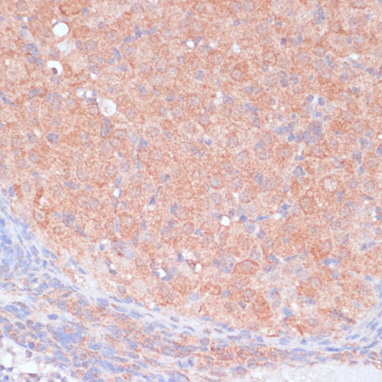 Immunohistochemistry - Anti-LRP1 Antibody (A13452) - Antibodies.com