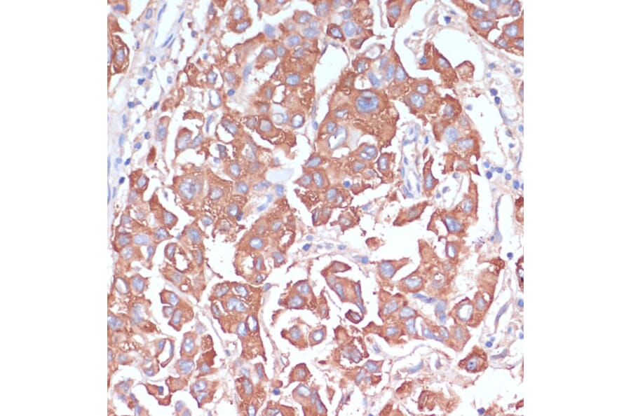 Immunohistochemistry - Anti-LRP1 Antibody (A13452) - Antibodies.com
