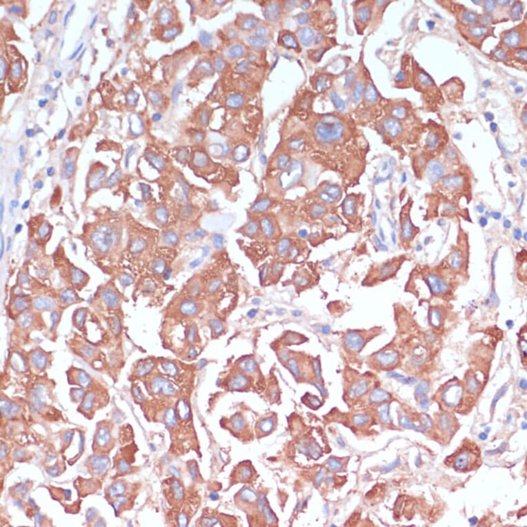 Immunohistochemistry - Anti-LRP1 Antibody (A13452) - Antibodies.com