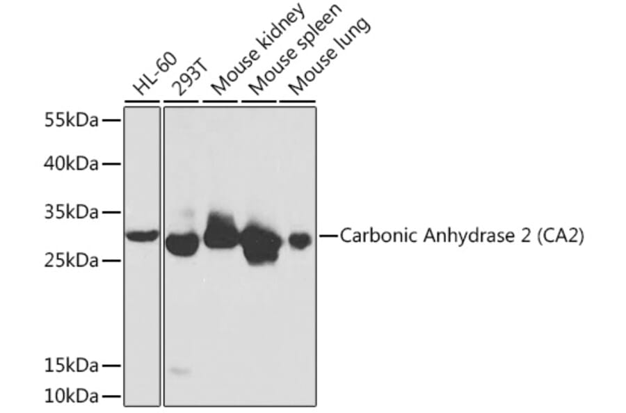 Western Blot - Anti-Carbonic anhydrase 2/CA2 Antibody (A13453) - Antibodies.com