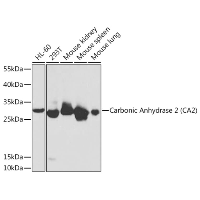 Western Blot - Anti-Carbonic anhydrase 2/CA2 Antibody (A13453) - Antibodies.com