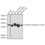 Western Blot - Anti-Carbonic anhydrase 2/CA2 Antibody (A13453) - Antibodies.com