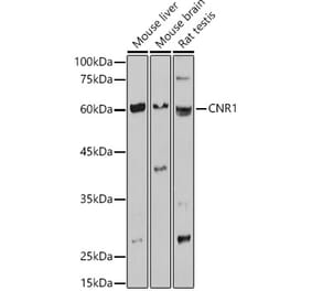 Western Blot - Anti-Cannabinoid Receptor I Antibody (A13455) - Antibodies.com