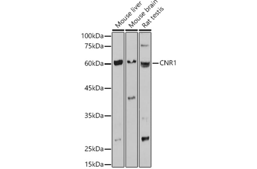 Western Blot - Anti-Cannabinoid Receptor I Antibody (A13455) - Antibodies.com