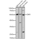 Western Blot - Anti-Cannabinoid Receptor I Antibody (A13455) - Antibodies.com