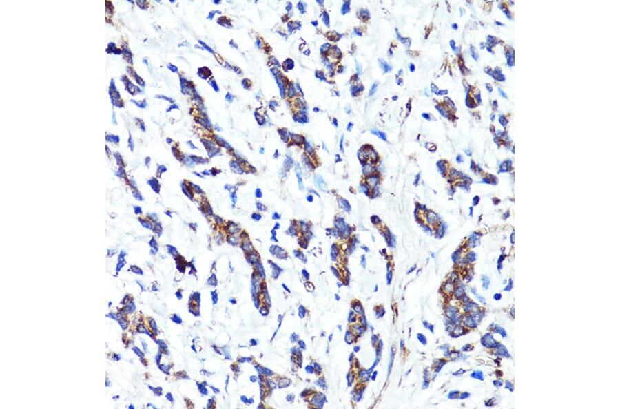 Immunohistochemistry - Anti-Cannabinoid Receptor I Antibody (A13455) - Antibodies.com