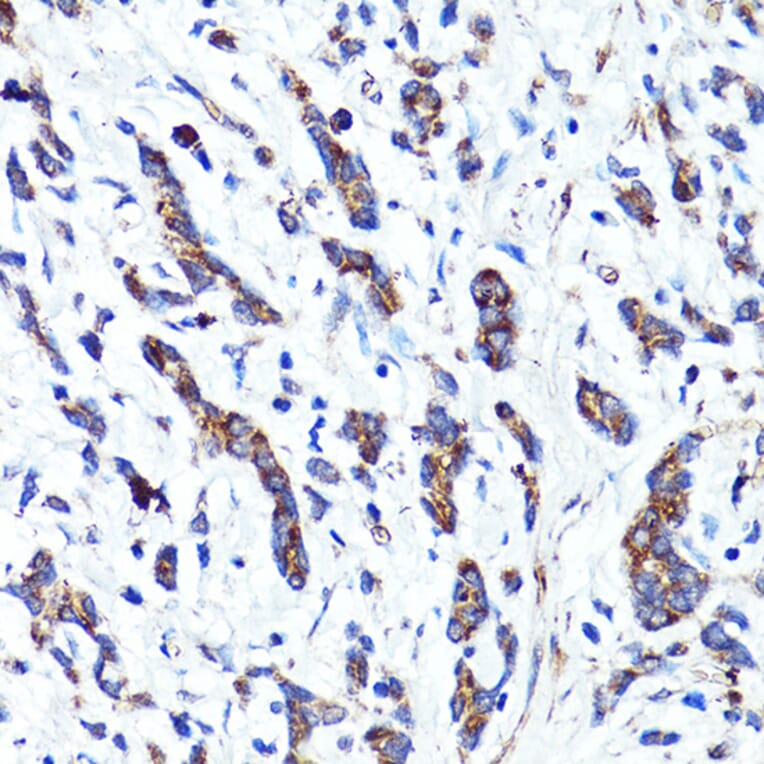 Immunohistochemistry - Anti-Cannabinoid Receptor I Antibody (A13455) - Antibodies.com