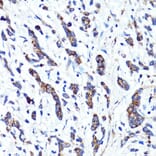 Immunohistochemistry - Anti-Cannabinoid Receptor I Antibody (A13455) - Antibodies.com