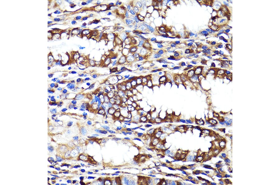 Immunohistochemistry - Anti-Cannabinoid Receptor I Antibody (A13455) - Antibodies.com