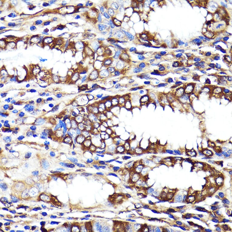 Immunohistochemistry - Anti-Cannabinoid Receptor I Antibody (A13455) - Antibodies.com
