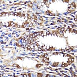 Immunohistochemistry - Anti-Cannabinoid Receptor I Antibody (A13455) - Antibodies.com