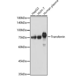 Western Blot - Anti-Transferrin Antibody (A13456) - Antibodies.com