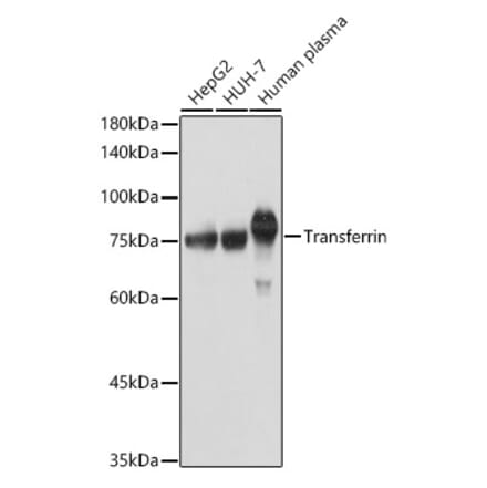 Western Blot - Anti-Transferrin Antibody (A13456) - Antibodies.com