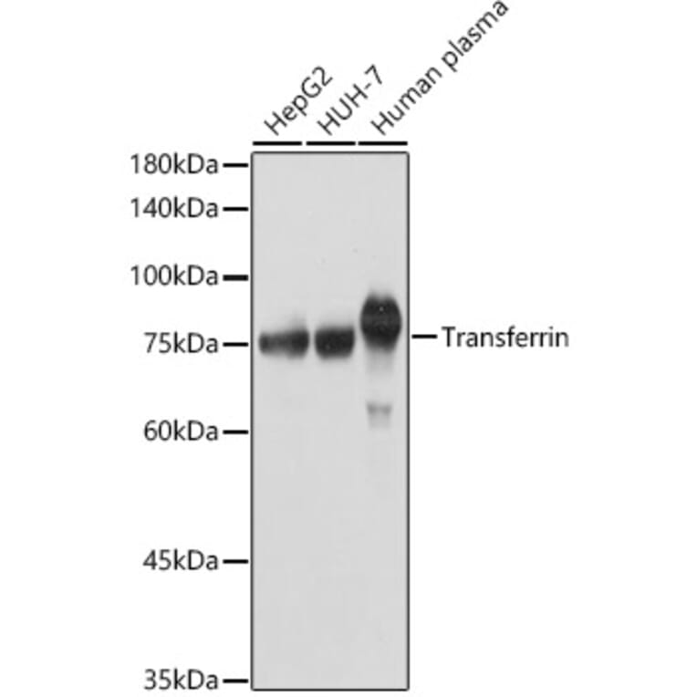 Western Blot - Anti-Transferrin Antibody (A13456) - Antibodies.com