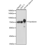 Western Blot - Anti-Transferrin Antibody (A13456) - Antibodies.com