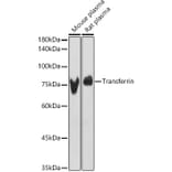 Western Blot - Anti-Transferrin Antibody (A13456) - Antibodies.com