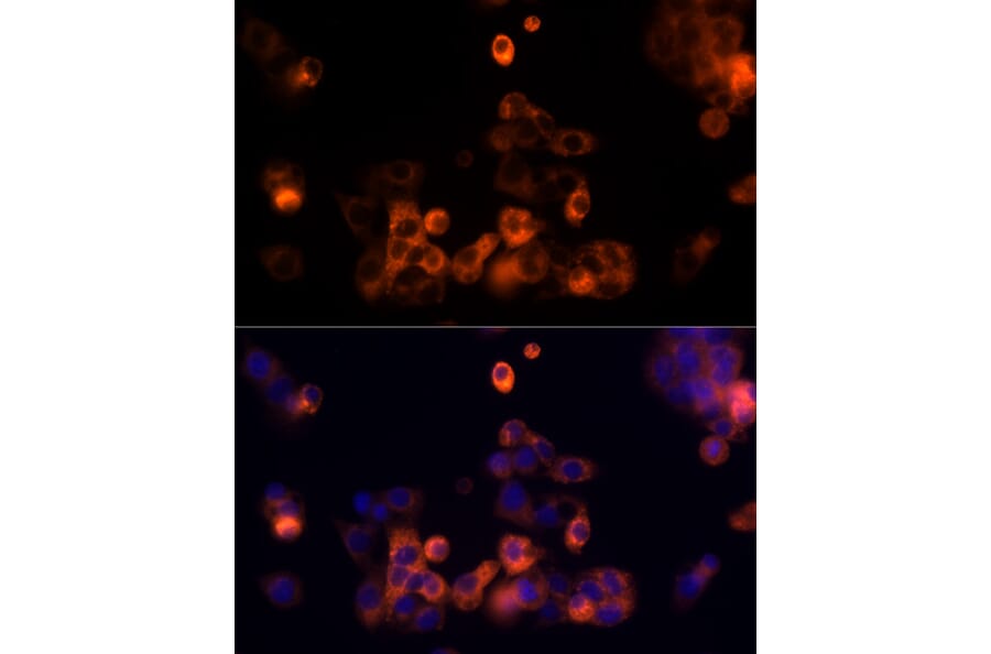Immunofluorescence - Anti-Transferrin Antibody (A13456) - Antibodies.com