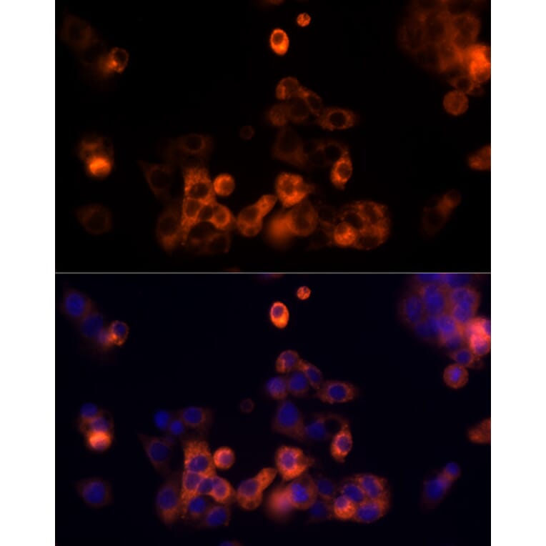 Immunofluorescence - Anti-Transferrin Antibody (A13456) - Antibodies.com