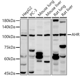 Western Blot - Anti-Aryl hydrocarbon Receptor Antibody (A13457) - Antibodies.com